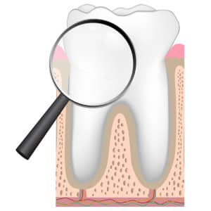 dentalcheckupmagnifying