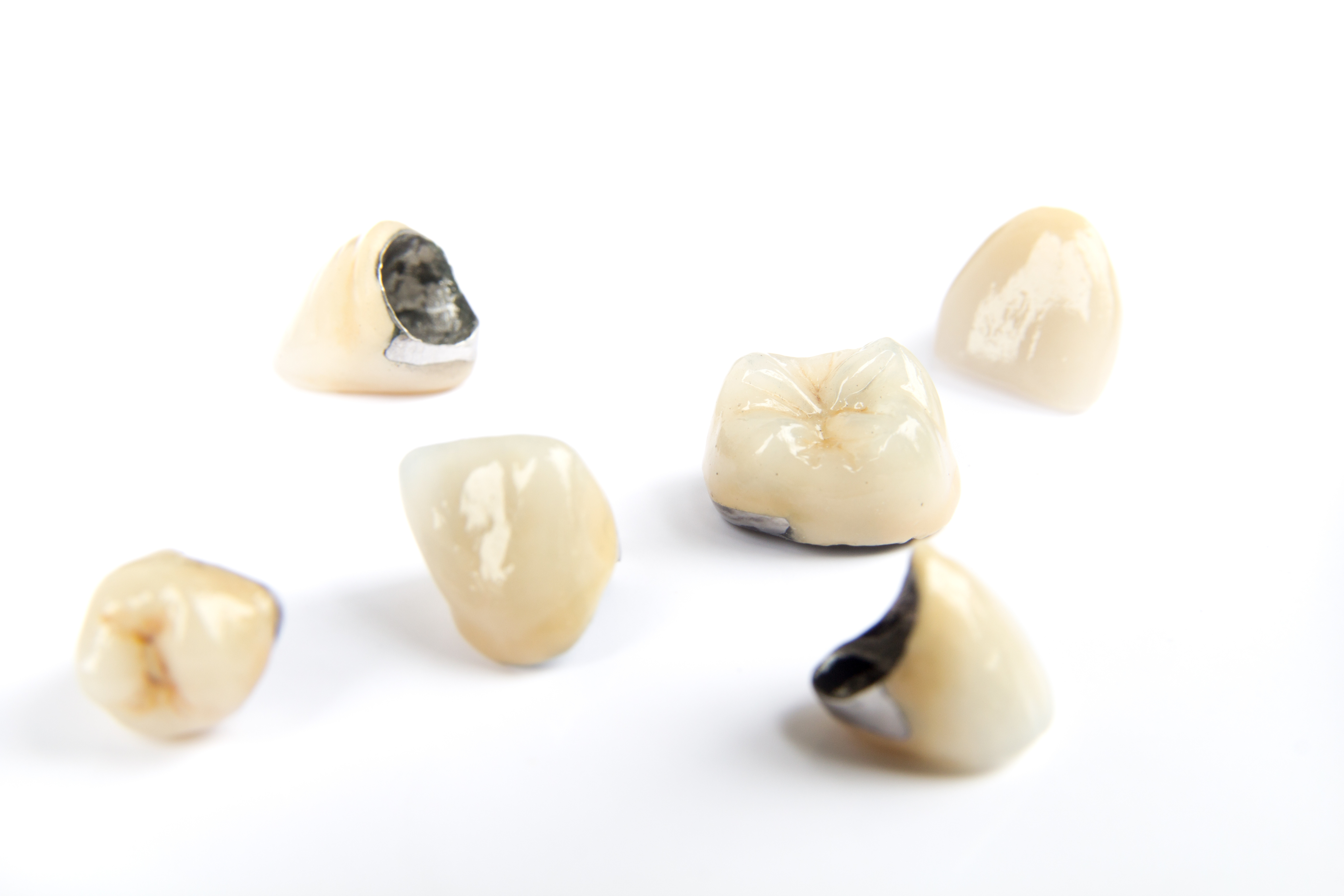 Richfield Dentist Offers Custom Crowns To Restore Your Smile