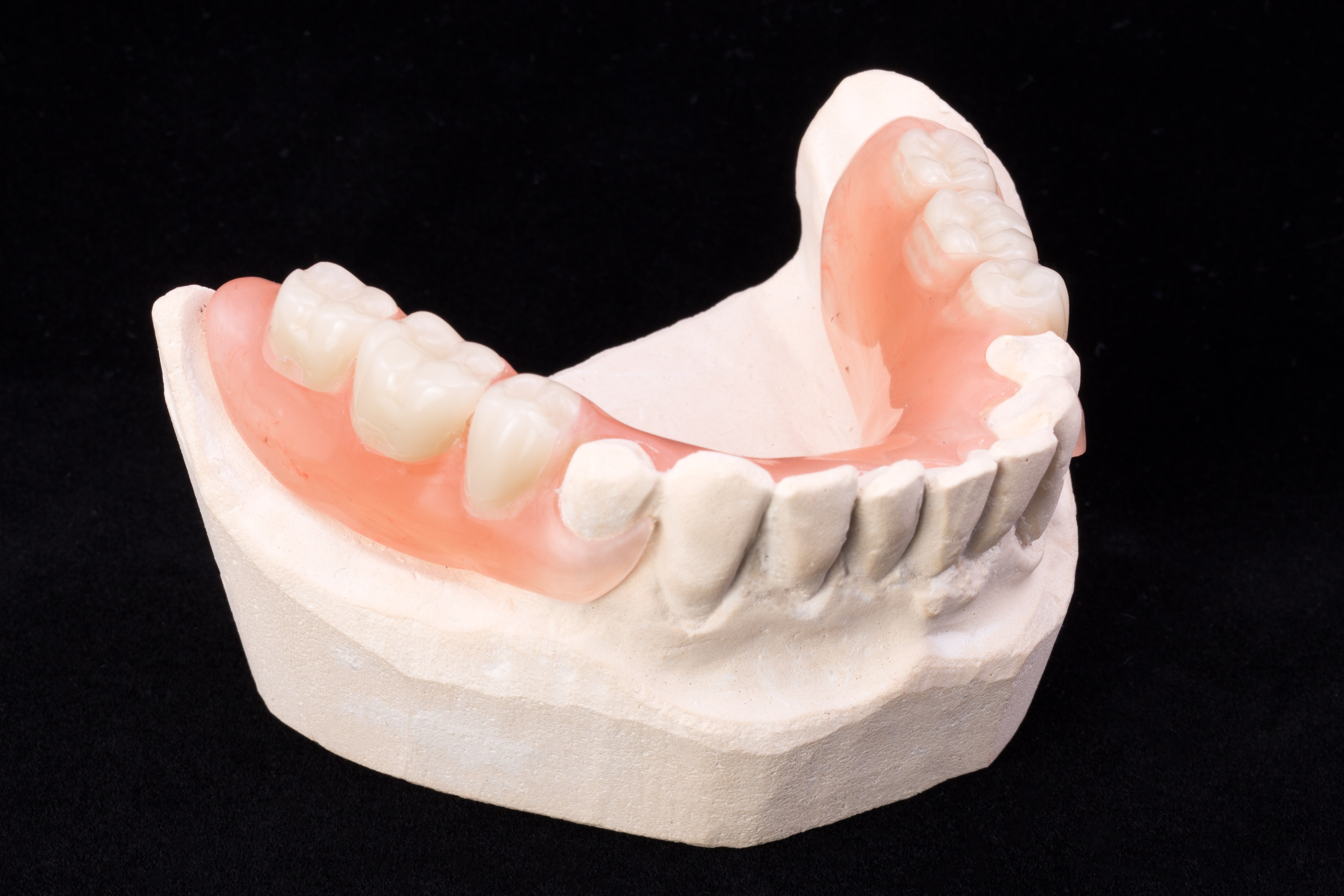 richfield-dentist-looks-at-when-to-consider-partial-dentures