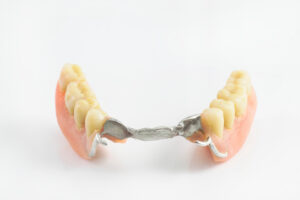 richfield partial dentures