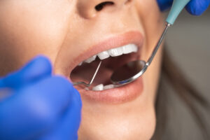 richfield dental cleanings