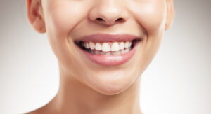 richfield dental bonding
