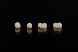 richfield crowns