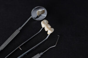 richfield dental crowns
