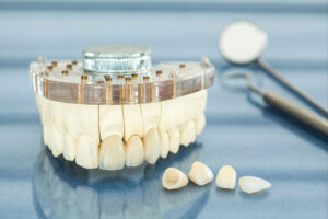 richfield crowns